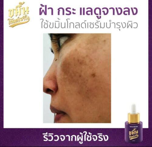 Turmeric Gold Serum Reduce Acne Dark Spot Wrinkles face 14 ml - Picture 15 of 23