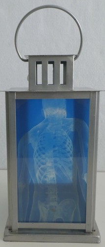 Lantern Medical Human XRAYS Images Brain Skeleton Candle Holder Medical - Imagen 4 de 6
