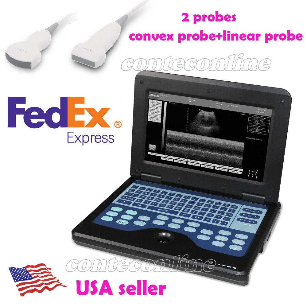 Portable B-Ultrasound Scanner Laptop Diagnostic Systems with 2 p