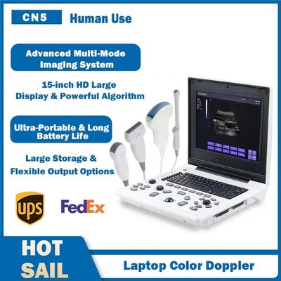 15'' Laptop Ultrasound Color Doppler Scanner for Clinic Use