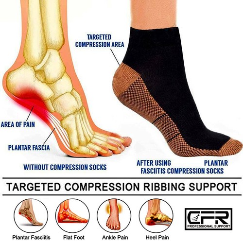 Men&Women Copper Compression Socks Arch Ankle Support Plantar Fasciitis Protect - Picture 3 of 15