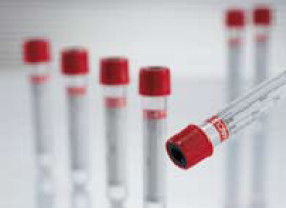 VACUETTE Z Serum Sep Clot Activator Venous Blood Collection Tube Clot Activator