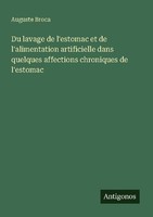 Du Lavage De L'estomac Et De L'alimentation Artificielle Dans Quelques Affection