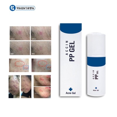 ACCIN PP AKNE GEL Lindert entzündliche Akne Behandlung und gereizte Haut 10 ml.