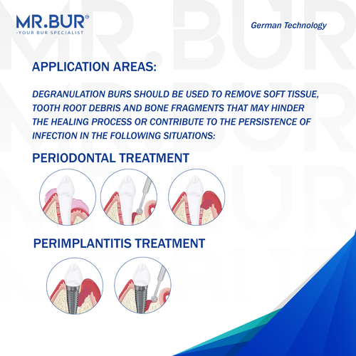 Degranulation Round Ball Cutter Burs Kit 1.0mm, 2.5mm,3.0mm,3.5mm | MR.BUR - Picture 4 of 7