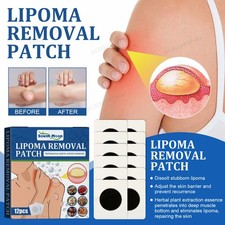 Body Patches for Lipoma Removal Soothing Various Subcutaneous Lumps Care Patch