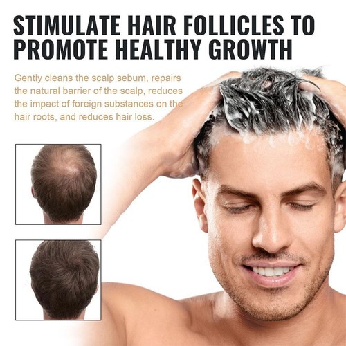 Spartan Shampoo, Spartan Root Activator Shampoo,Natural Hair Regrōwth ShampoosUS - Picture 8 of 14