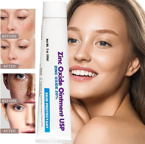 removing zinc oxide from skin