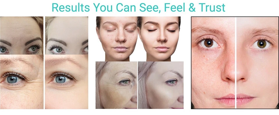 HYALURONIC ACID Serum 100% Pure Organic Anti Aging Wrinkles Fine Lines 16 oz - Image 3 of 4