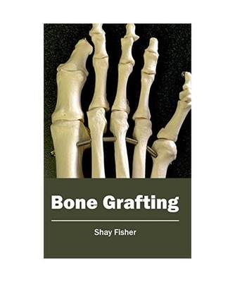 Bone Grafting
