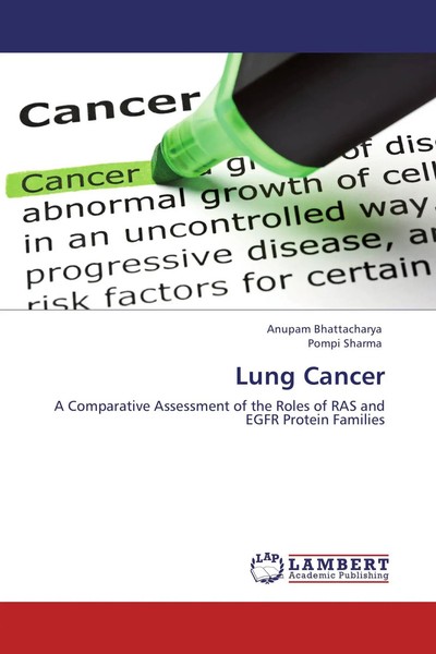 Anupam Bhattacharya (U. A.) | Lung Cancer | Taschenbuch | Englisch (2012)-image