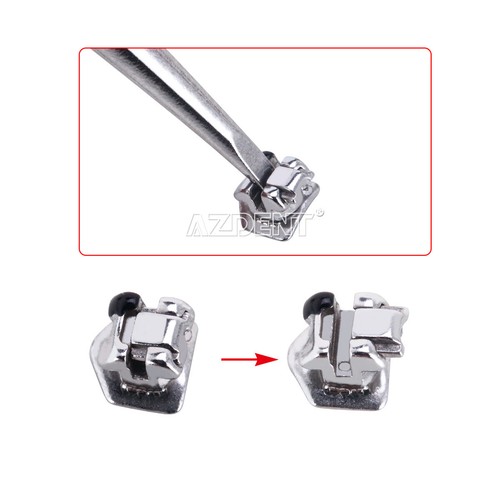 Dental Ortho Self-Ligating Brackets Braces /Heat Thermal Activated Arch Wire - Picture 34 of 79