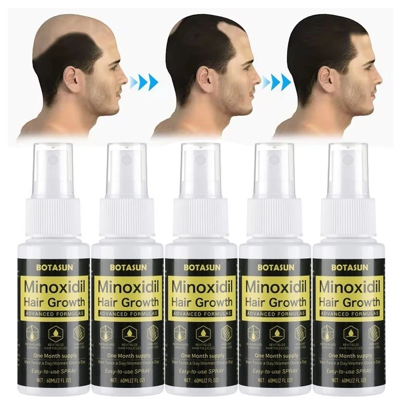 5Pcs Minoxidil 5% Extra Strength-Men Hair Regrowth Treatment Thicker Hair Growth