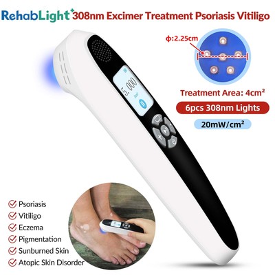 308nm UVB Light Therapy Device w/ Rechargeable Battery & Charger for Skin Care