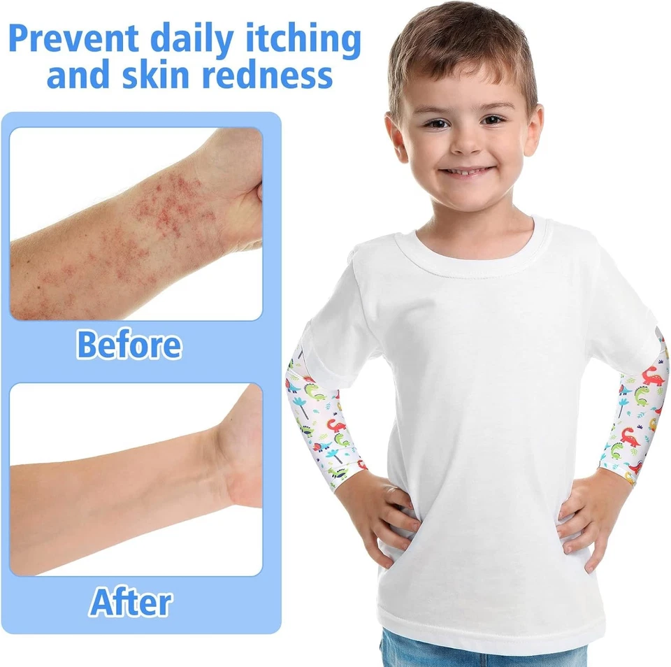 12 Pairs Eczema Sleeves for Kids Elastic Eczema Arm or Leg Sleeves Kids Arm Slee - image 2 of 4