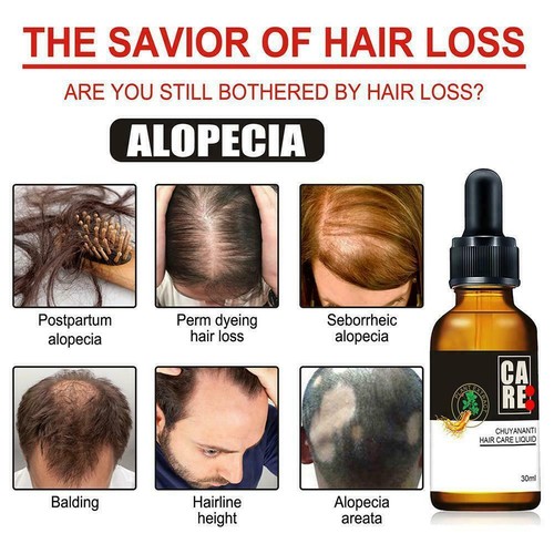 7 Days Products For Men Women Natural Serum Fast Oil Grow G7N9 - Picture 6 of 11