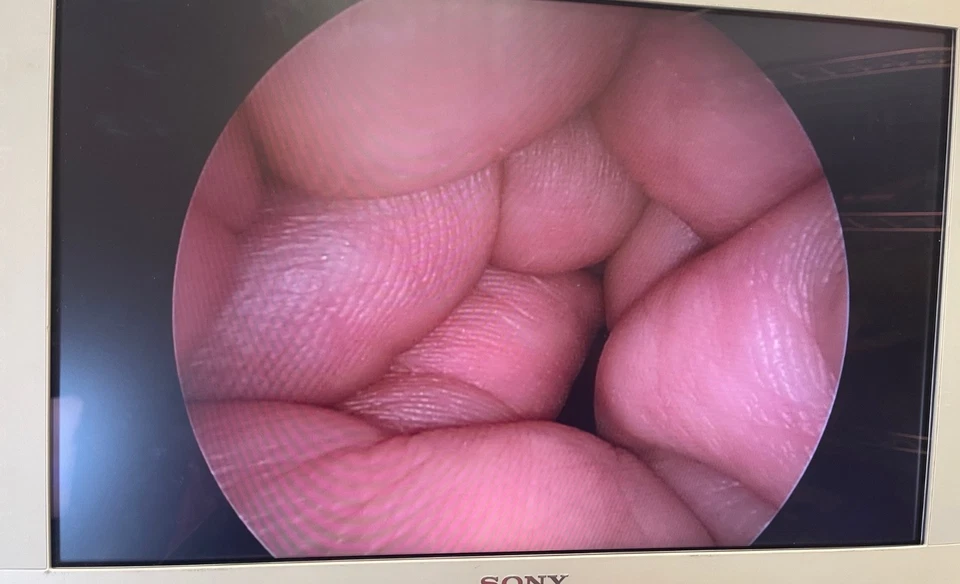 Laparoscopio autoclavable Karl Storz 26046BA 5mm x 30º x 29cm Hopkins II Foto 2 de 4