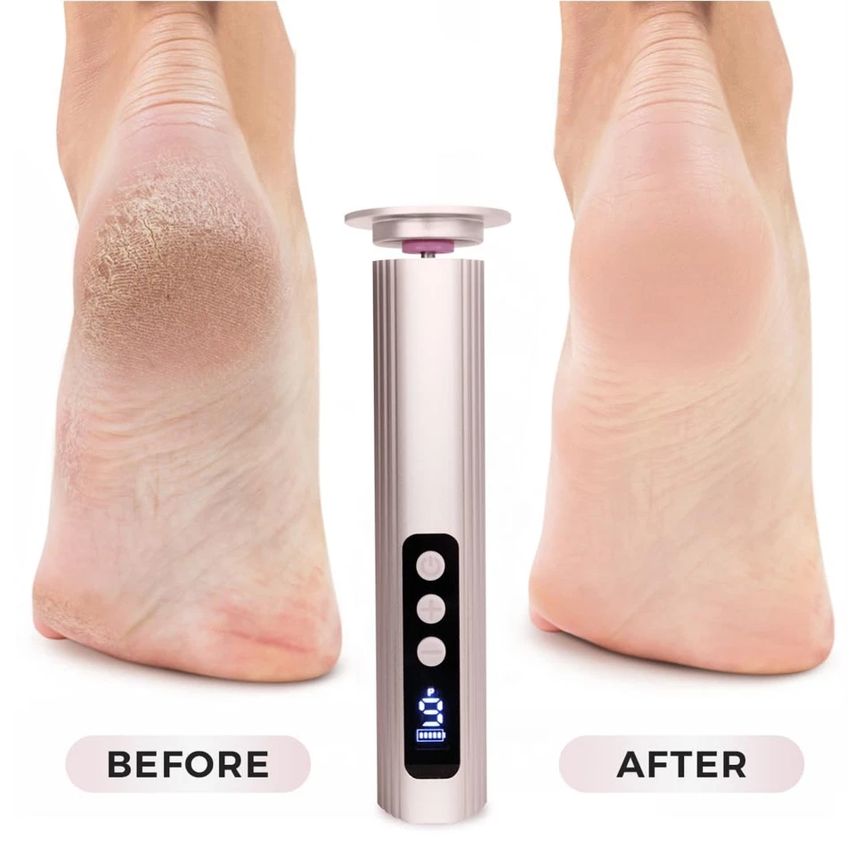 Electric Foot Callus Remover with Nano Glass Head, 9-Speed Rechargeable Foot ... - Image 3 of 4
