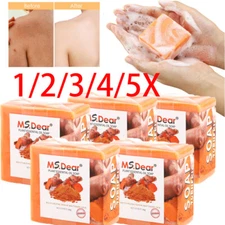 5/1x Tumeric Soap Skin Whitening Dark Spots lightening Acne Brightening Turmeric