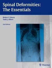 Spinal Deformities | The Essentials | Robert ...