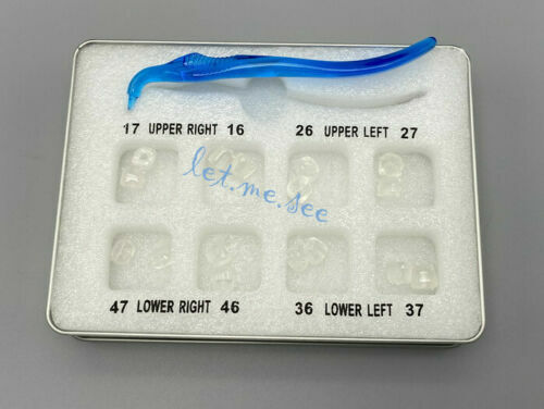 Dentle Orthodontic Implant Locator Polishing Retractor Opener Posterior Matrix - Picture 19 of 25