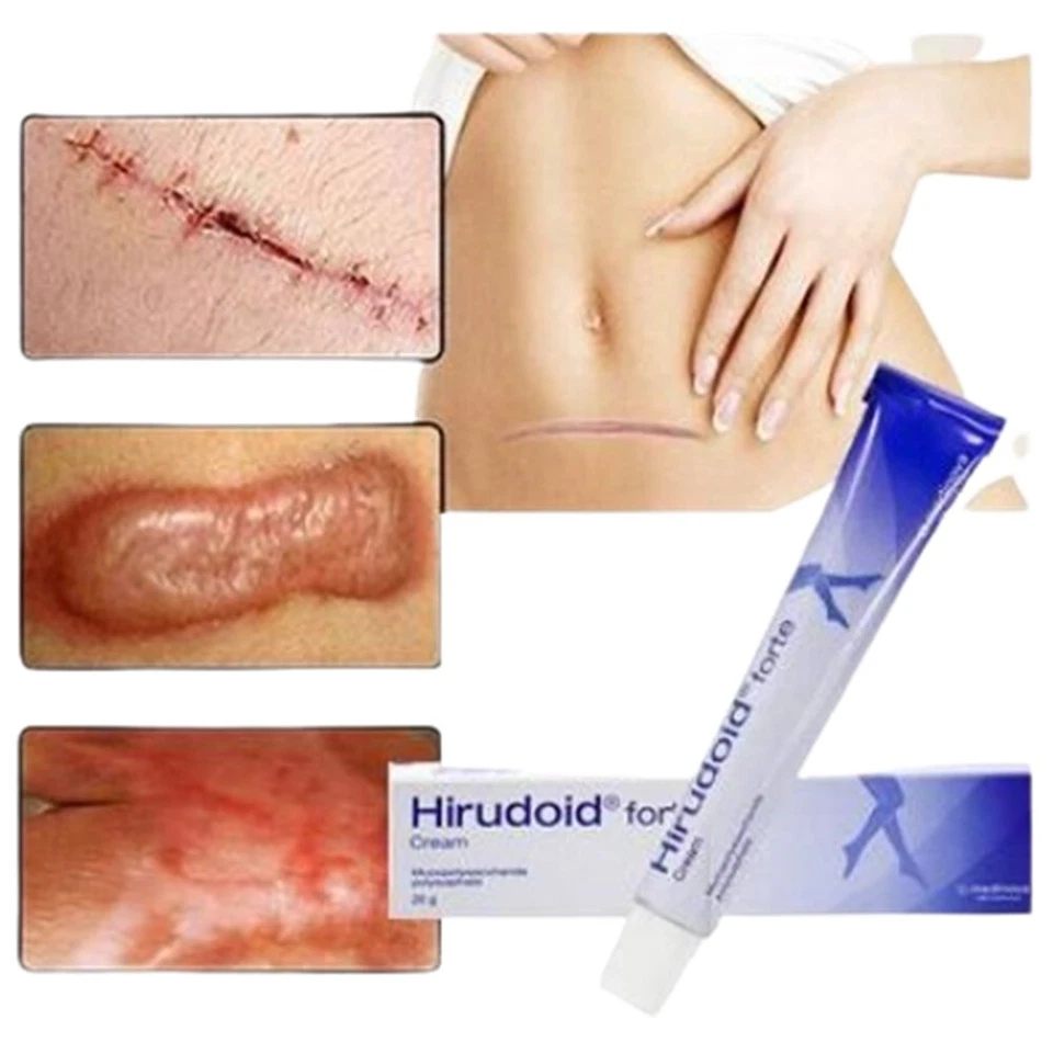 Cream Hirudoid Forte Relieves Scars Bruises Varicose veins Inflamed 10,20,40 g. - Image 2 of 3