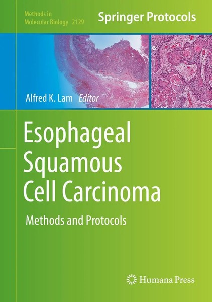 Alfred K. Lam | Esophageal Squamous Cell Carcinoma | Buch | Englisch (2020) | X-image