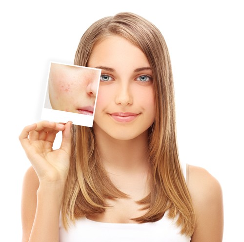 DIAMOND VACUUM MICRODERMABRASION MACHINE - 6 FACE AND BODY TIPS- AUSSIE SELLER - Picture 5 of 6