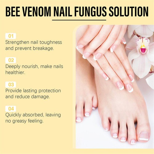 10ML Toe Fungus Nail Treatment Care Liquid Bee Venom Nail Fungus Serum- - Picture 8 of 12