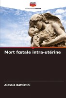 Alessio Battistini | Mort F¿Tale Intra-UtéRine | Taschenbuch | FranzöSisch