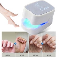 Fungus Laser Nail Treatment Device Dual 940nm 500nm Light for Home Foot Care USA