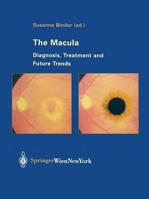 The Macula: Diagnosis, Treatment and Future Trends by Susanne Binder (English) P