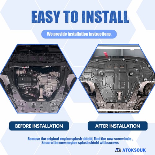 For Hyundai Sonata 2024-2025 Under Engine Splash Guards Front Engine Mud Flaps - Picture 12 of 14