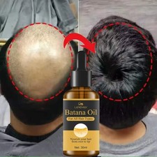 Batana Oil Hair  Scalp Serum   Nourishing Care for Dry, Damaged Hair  Women 