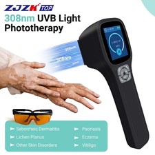 308nm Excimer UVB Light Therapy Device for Skin Conditions Eczema Home Use