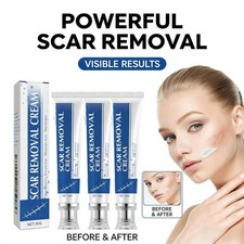 Scar Removal Cream Weaken Surgical Scar Trauma Relief Tighten Skin 30g US