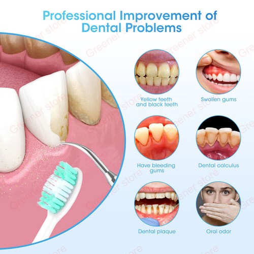 Potente rimozione piastra ad ultrasuoni per denti con 5 modalità - pulizia denti - Foto 2 di 20