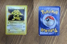 Electabuzz 20/102 Rare Base Set Shadowless Pokemon HP