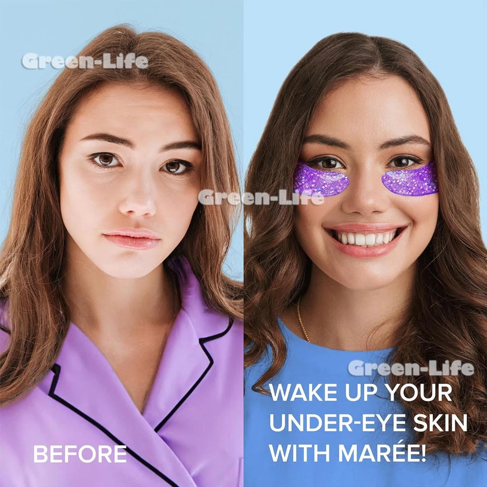 Under Eye Patches for Dark Circles & Puffy Eyes (6 Pairs, 12PCS) Marine Collagen - Image 3 of 4