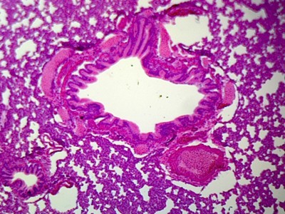 Lung Section by Go Science Crazy