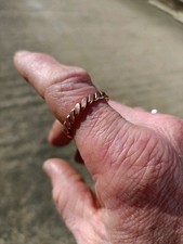 Flattened Lost Cubit Tensor Ring Finger. Zero-point Energy 177 Hz Frequency 