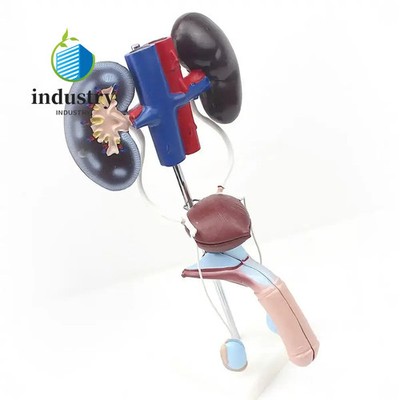 3 Parts Human Male Stereourinary Kidney Ureter Bladder Model Surgeon Medical