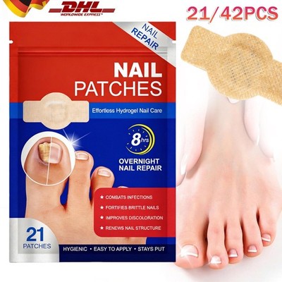 1/2PACK Eingewachsene Zehennägel Korrektur Aufkleber Nagelkorrektur Patch Satz