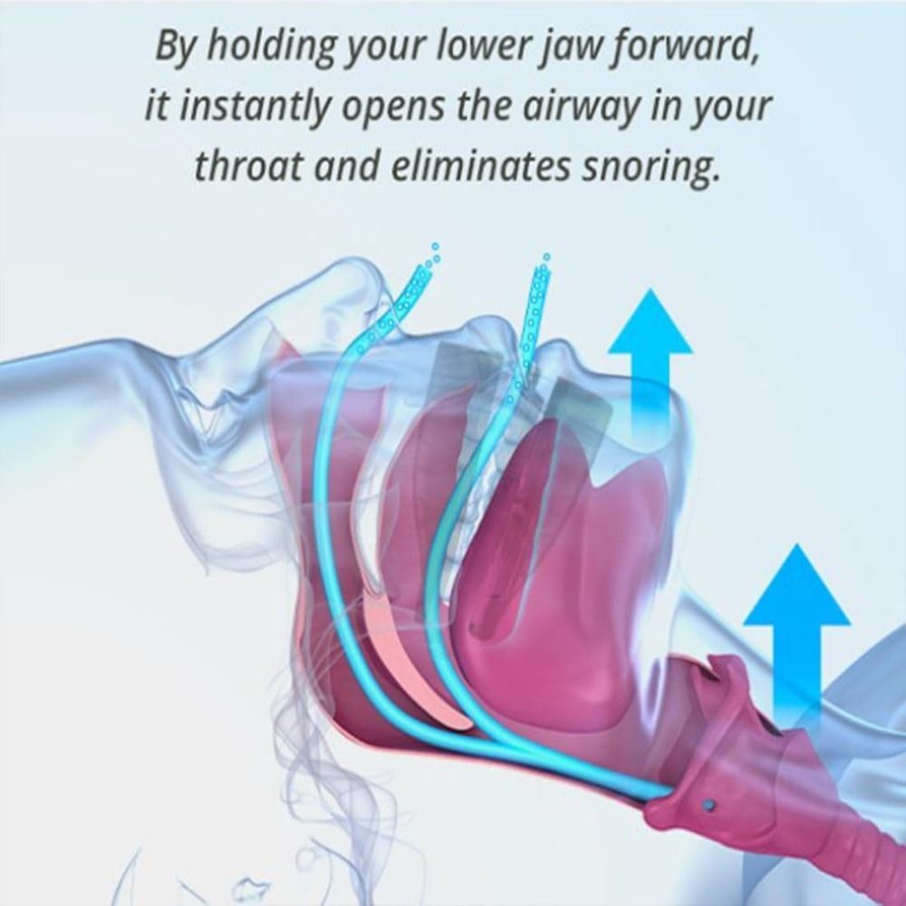 AntiSnoring Dental Device Adjustable Denture Teeth Whitening Sleeping 736333282782 eBay