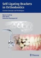 Self-Ligating Brackets In Orthodontics: Current Concepts And Techniques Bjö