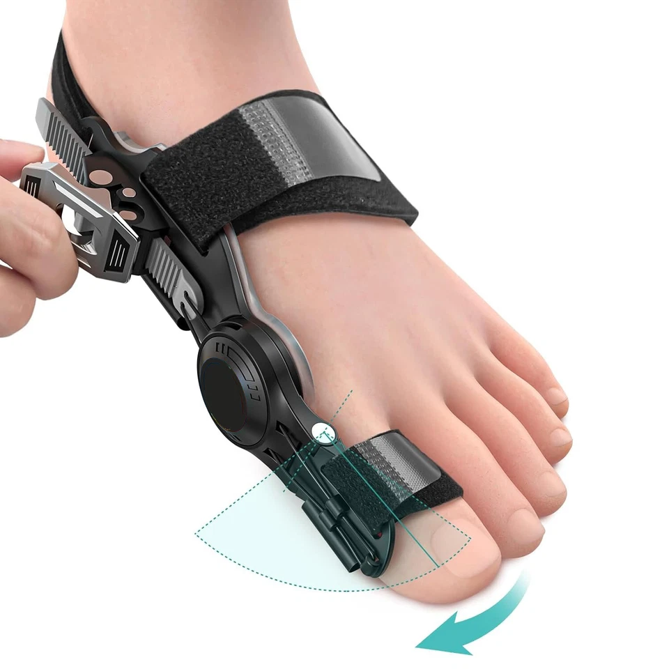 Corrector de juanete Hallux Valgus mejorado separador ortopédico de dedos grandes para mujeres y hombres Foto 4 de 4