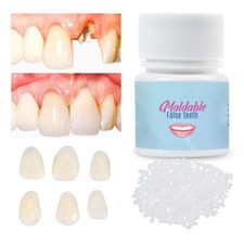 Tooth Kit Temp Repair Replace Missing DIY Safe Easy teeth FalseTeeth Solid Glue