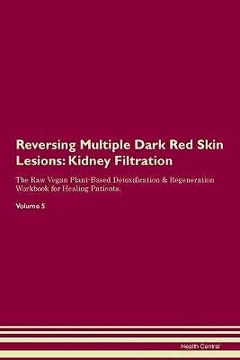 Reversing Multiple Dark Red Skin Lesions Kidney Fi