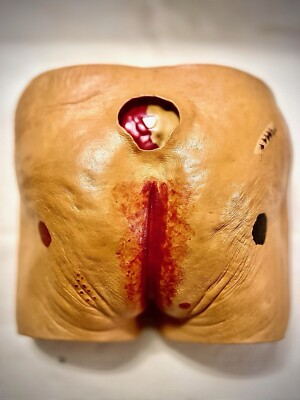 #ad SEYMOUR BUTTS Wound Model Light Brown Skin With Pressure Injury Staging $425.00
