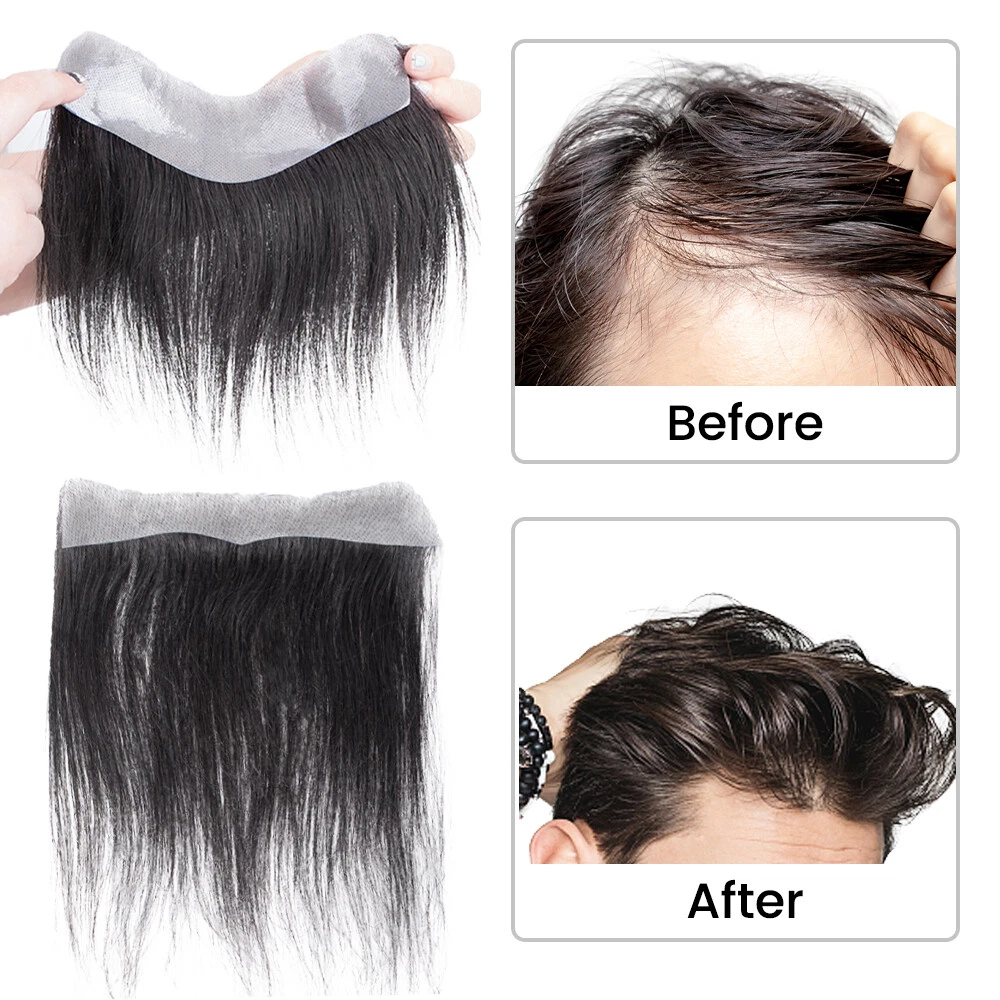 Hairline hair piece outlet